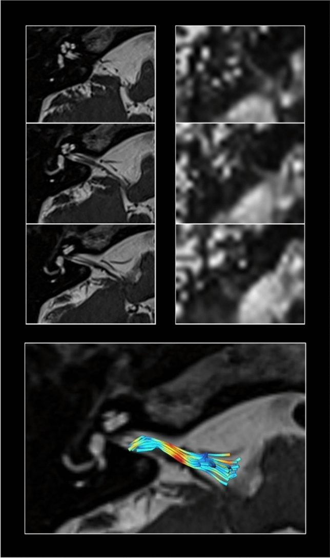 Fig. 2