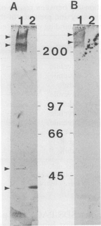 graphic file with name iai00027-0277-a.jpg