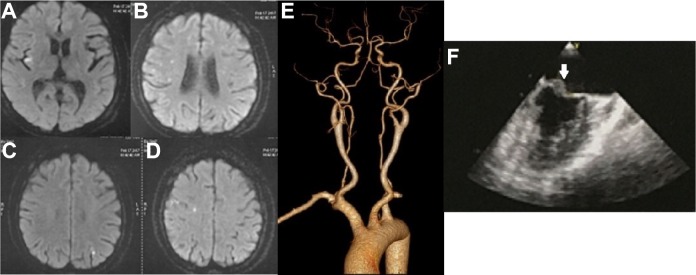 Fig 2.