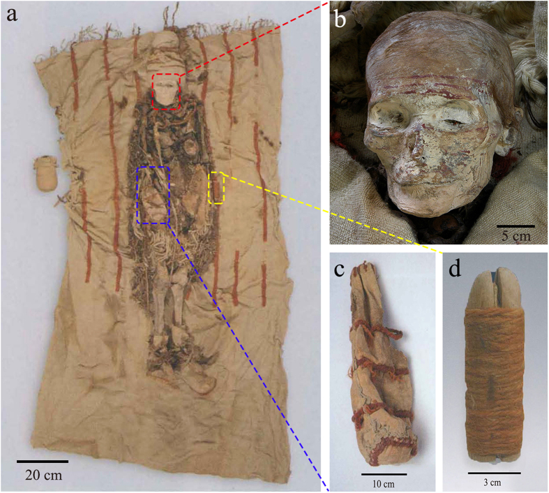 Figure 2