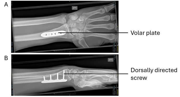 Figure 5