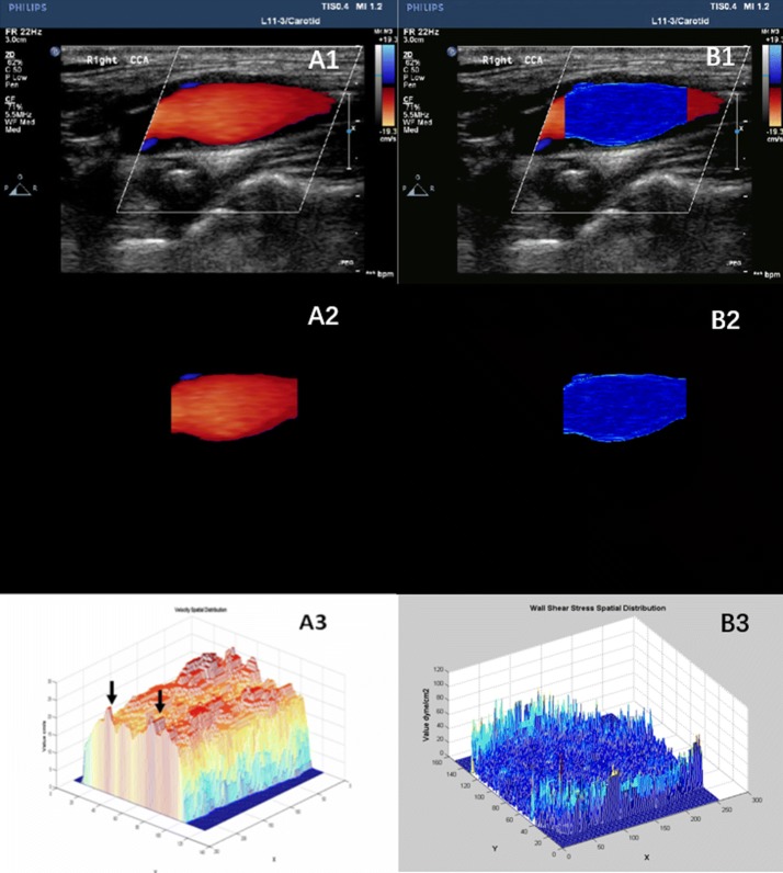 Fig. 1