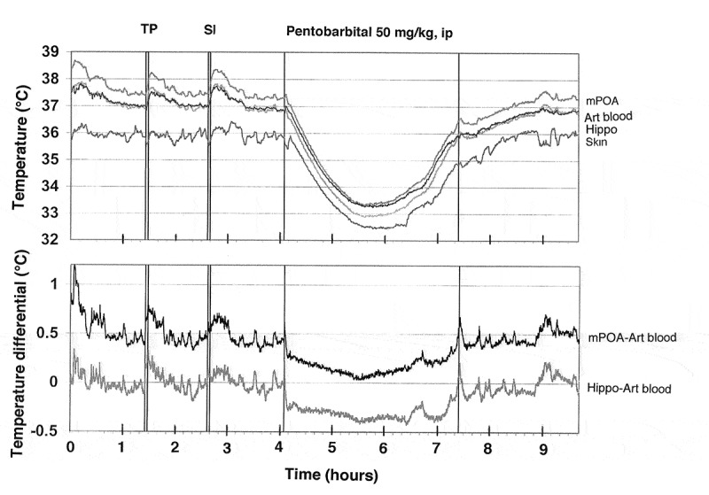 Figure 12.