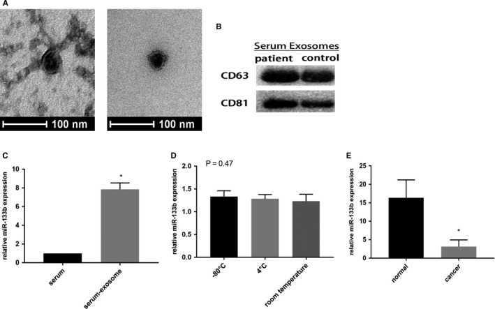 Exosome–transmitted microRNA‐133b inhibited bladder cancer ...