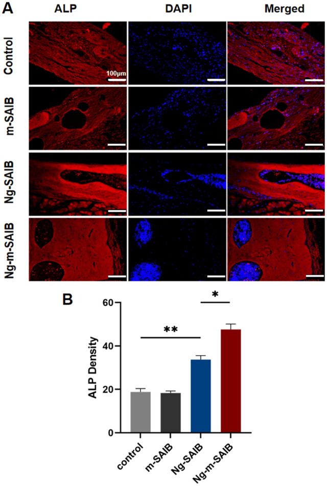 Figure 11.