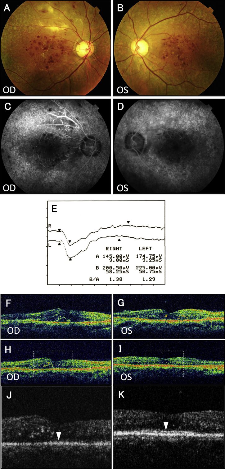 Fig. 1