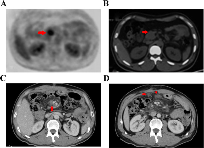 Fig. 1