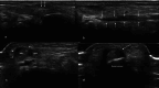 Fig. 9