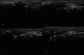 Fig. 19