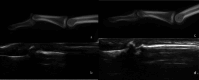 Fig. 21