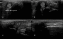 Fig. 11