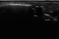 Fig. 20