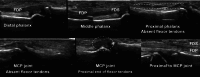 Fig. 13