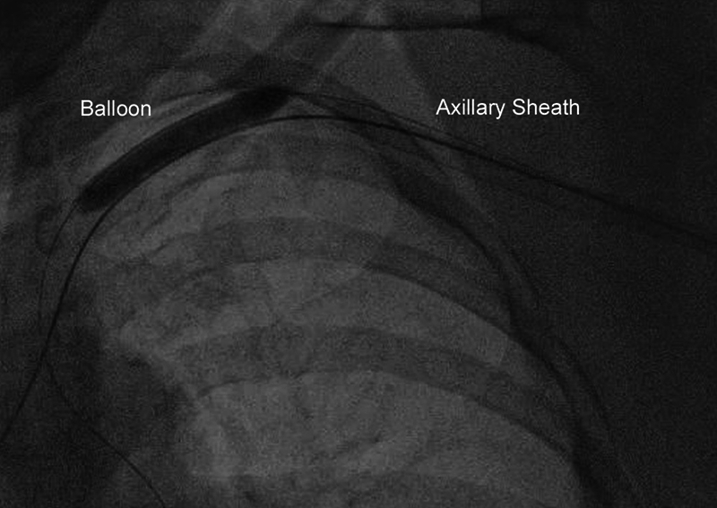 Figure 4