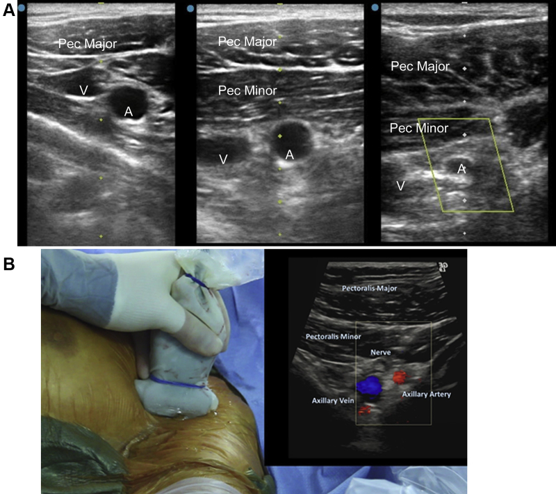 Figure 2