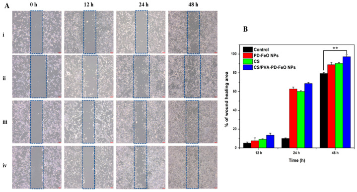 Figure 13