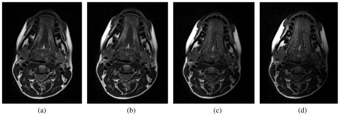 Fig. 11