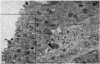 107