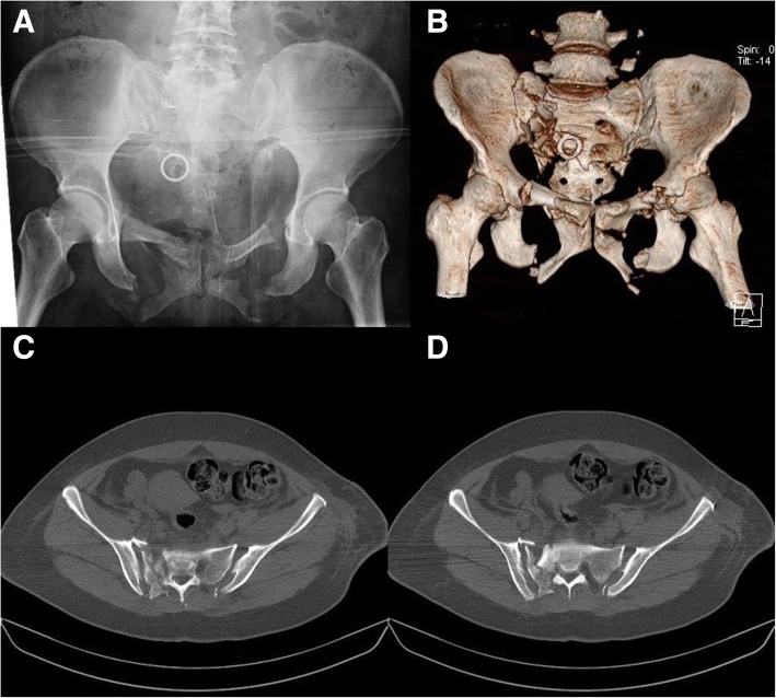 Fig. 1