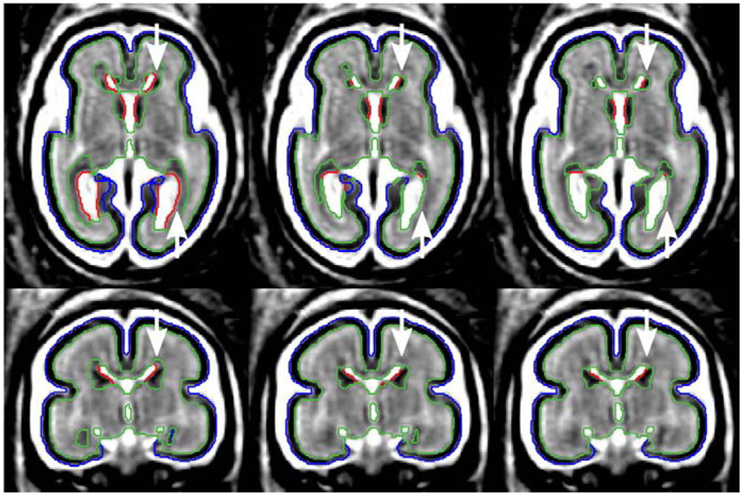 Fig. 15