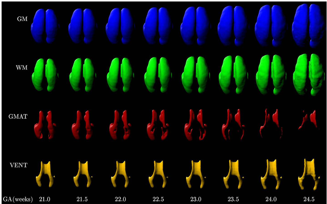 Fig. 14