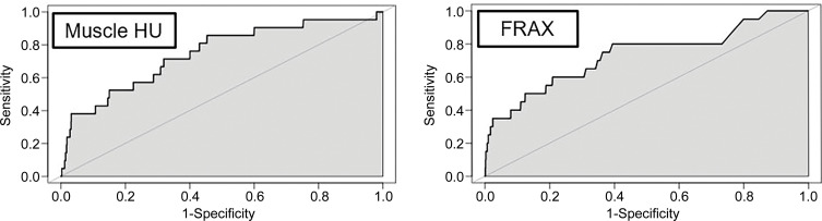 Receiver operating characteristic (ROC) curves for predicting future fragility fractures. (a) ROC curves for predicting any fragility fracture over a 2-year time horizon shows comparable performance between the univariable L1-bone attenuation (area under the ROC curve [AUC] = 0.71) and the multivariable Fracture Risk Assessment Tool (FRAX) (AUC = 0.72), whereas visceral-to-subcutaneous (V/S) fat ratio was a poor predictor (AUC = 0.51). When bone attenuation and muscle attenuation are combined, the performance improves slightly (AUC = 0.73). (b) ROC curves for predicting hip fractures over a 2-year time horizon show that the univariable muscle attenuation alone (AUC = 0.75) compares favorably with the multivariable FRAX (AUC = 0.73). When bone attenuation and muscle attenuation are combined (not shown), the performance is further improved, albeit only slightly (AUC = 0.76).