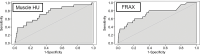 Receiver operating characteristic (ROC) curves for predicting future fragility fractures. (a) ROC curves for predicting any fragility fracture over a 2-year time horizon shows comparable performance between the univariable L1-bone attenuation (area under the ROC curve [AUC] = 0.71) and the multivariable Fracture Risk Assessment Tool (FRAX) (AUC = 0.72), whereas visceral-to-subcutaneous (V/S) fat ratio was a poor predictor (AUC = 0.51). When bone attenuation and muscle attenuation are combined, the performance improves slightly (AUC = 0.73). (b) ROC curves for predicting hip fractures over a 2-year time horizon show that the univariable muscle attenuation alone (AUC = 0.75) compares favorably with the multivariable FRAX (AUC = 0.73). When bone attenuation and muscle attenuation are combined (not shown), the performance is further improved, albeit only slightly (AUC = 0.76).
