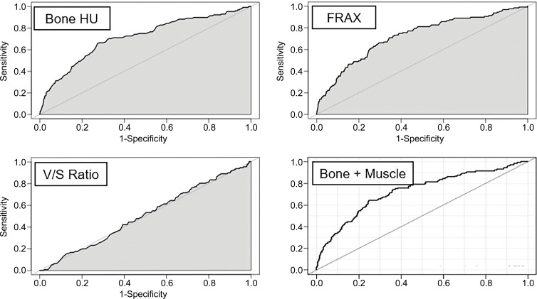 Receiver operating characteristic (ROC) curves for predicting future fragility fractures. (a) ROC curves for predicting any fragility fracture over a 2-year time horizon shows comparable performance between the univariable L1-bone attenuation (area under the ROC curve [AUC] = 0.71) and the multivariable Fracture Risk Assessment Tool (FRAX) (AUC = 0.72), whereas visceral-to-subcutaneous (V/S) fat ratio was a poor predictor (AUC = 0.51). When bone attenuation and muscle attenuation are combined, the performance improves slightly (AUC = 0.73). (b) ROC curves for predicting hip fractures over a 2-year time horizon show that the univariable muscle attenuation alone (AUC = 0.75) compares favorably with the multivariable FRAX (AUC = 0.73). When bone attenuation and muscle attenuation are combined (not shown), the performance is further improved, albeit only slightly (AUC = 0.76).