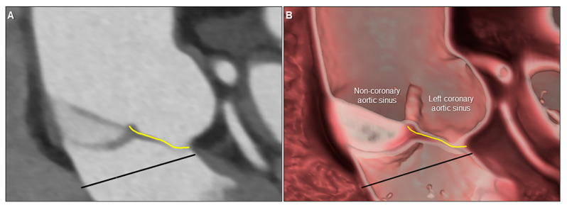 Figure 19