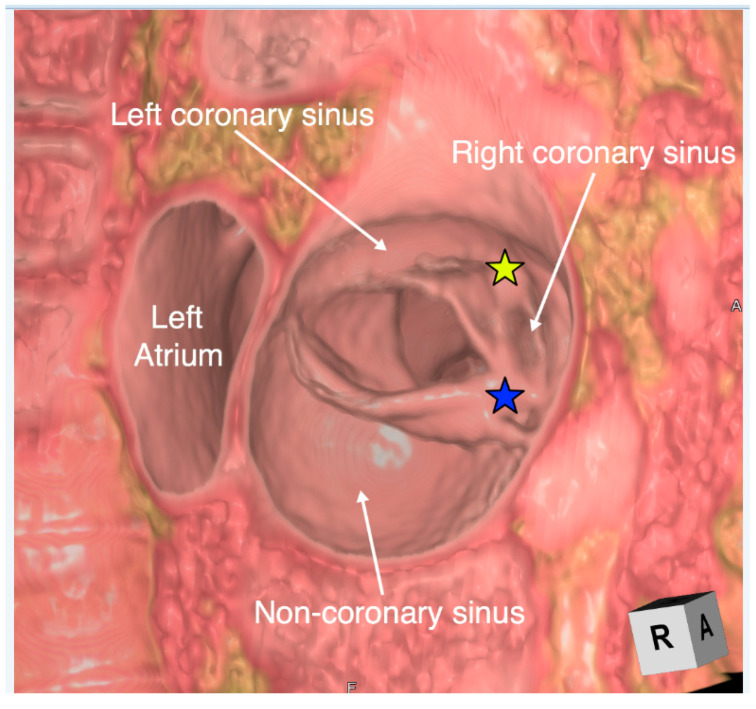 Figure 14