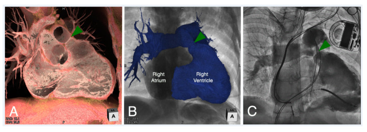 Figure 16