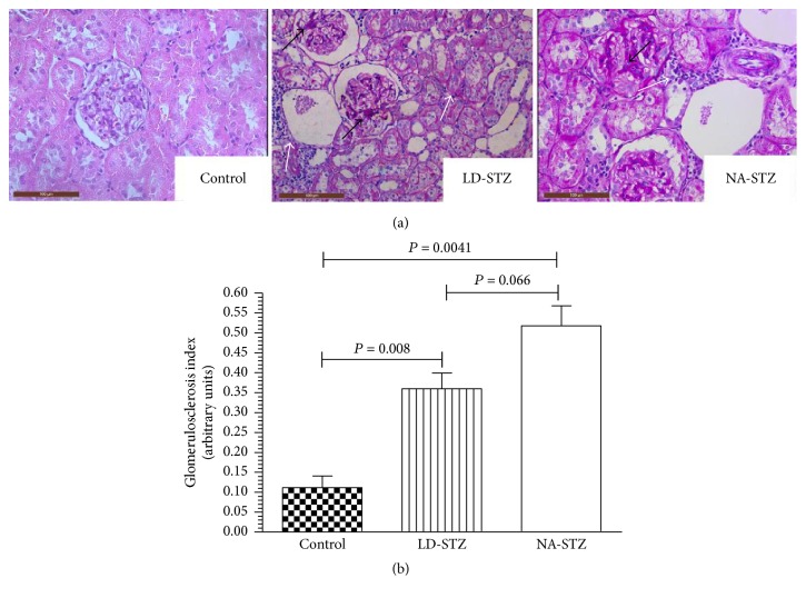 Figure 11