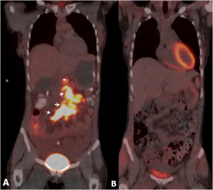 Fig. 7