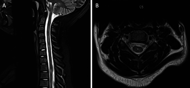 FIG. 2.