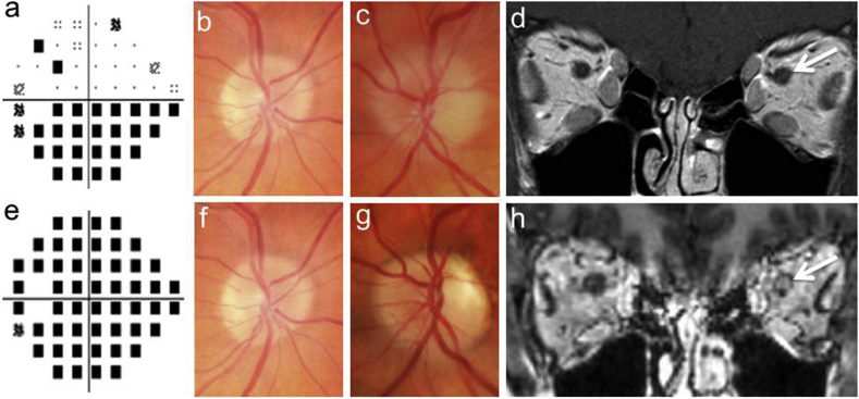 Fig. 1