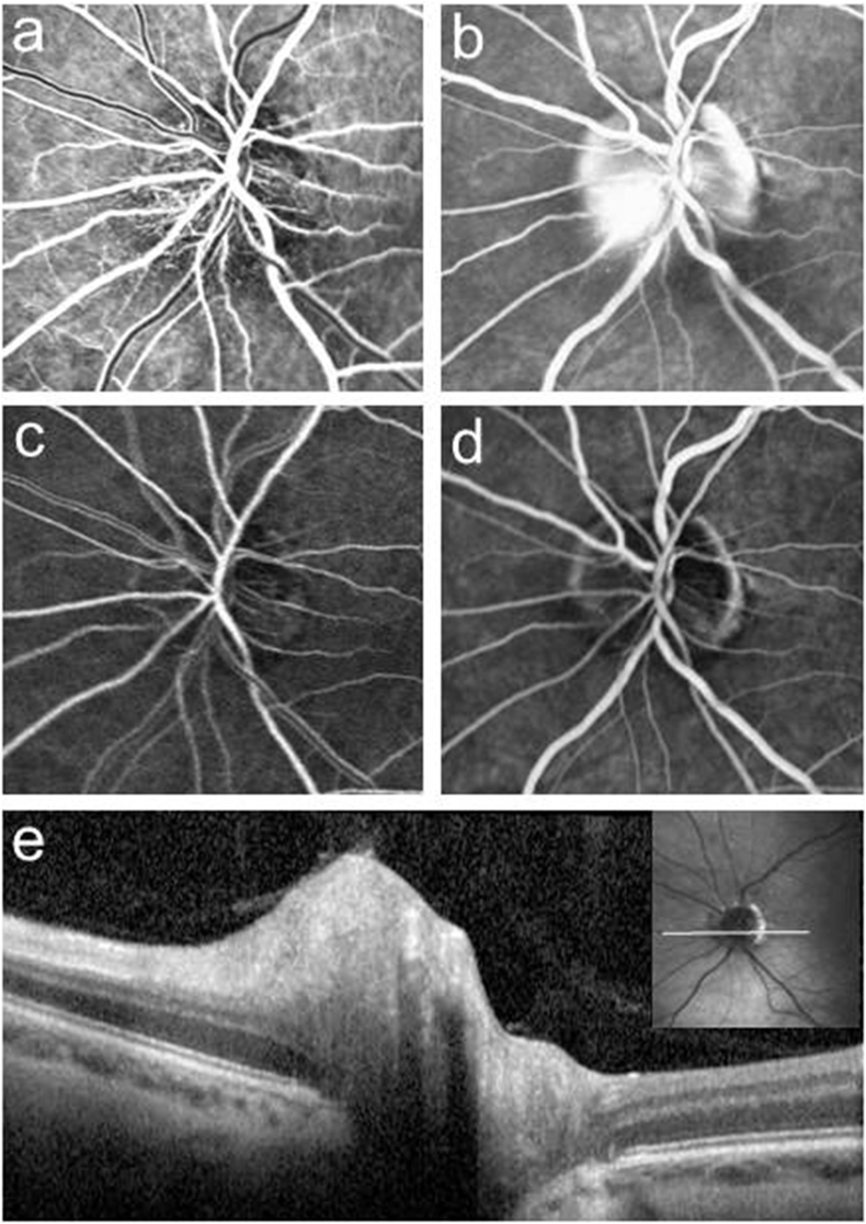 Fig. 2