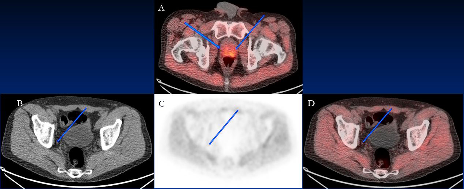 Figure 2: