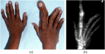 Figure 16.