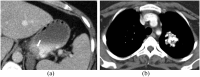 Figure 14.