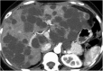 Figure 11.