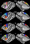 Fig 11