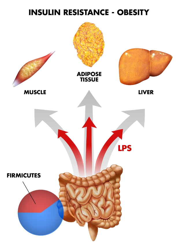 Gut microbiota can nullify the genetic protection against insulin resistance in TLR2-deficient mice by increasing intestinal permeability. 