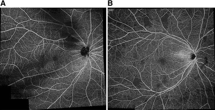 Fig. 2