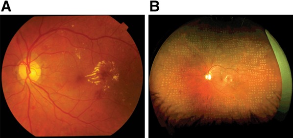 Fig. 1