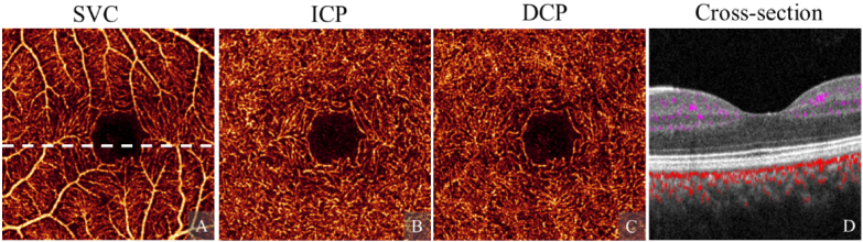 Fig. 3.