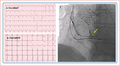 Figure 3: