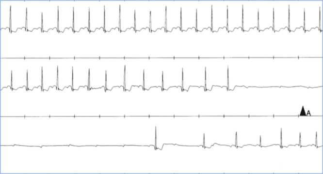 Fig. 2.