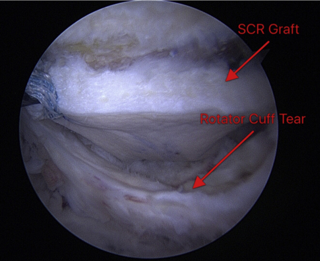 Fig 6