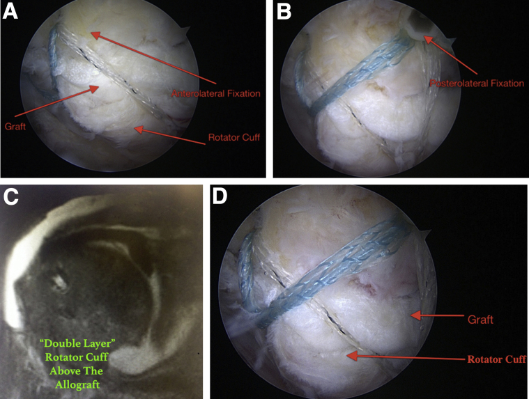 Fig 8