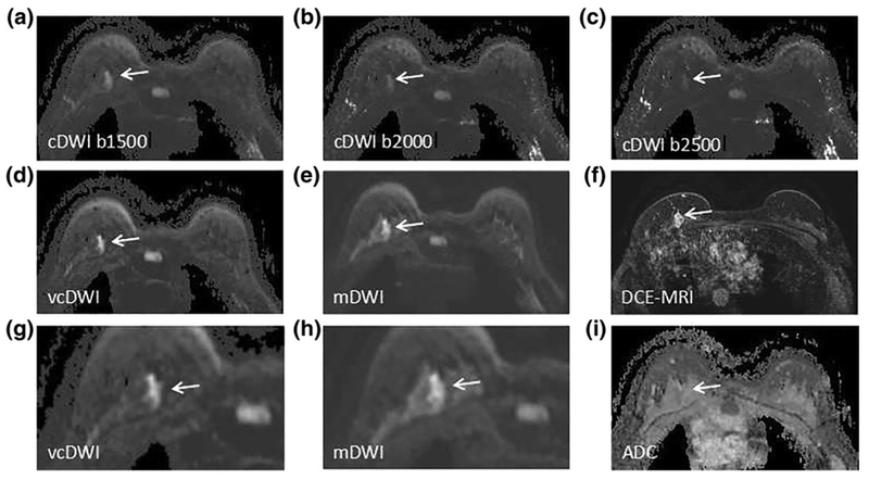 FIGURE 1: